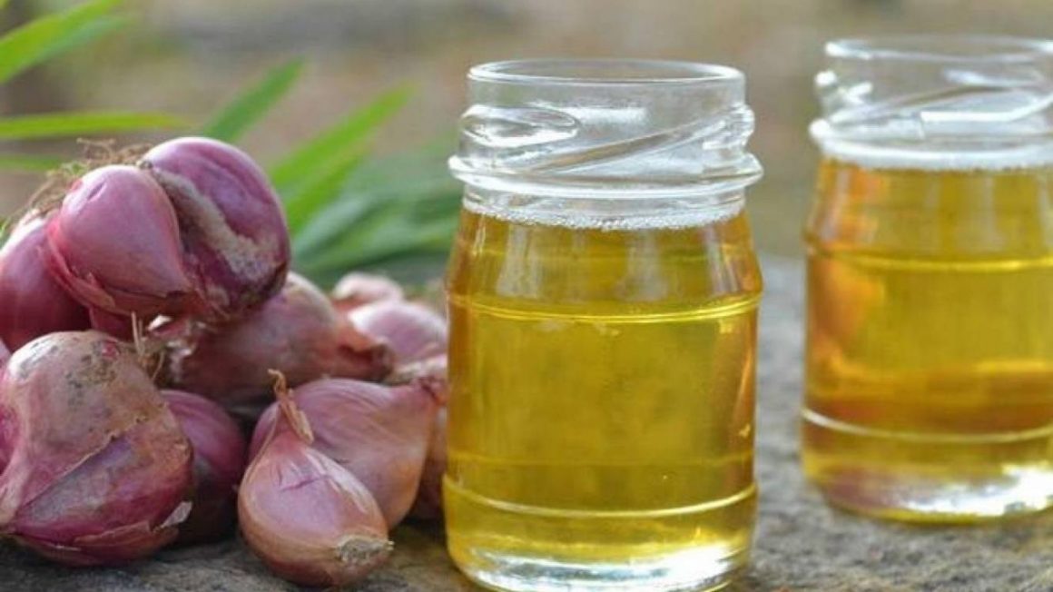 Onion hair oil & its magical benefits